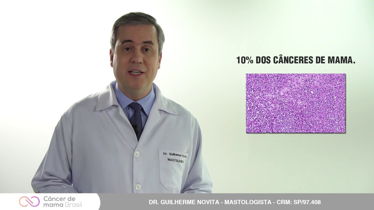 CARCINOMA LOBULAR INVASIVO