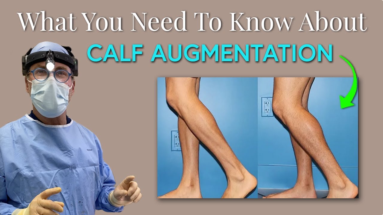No More Skinny Legs!! Calf Augmentation with Dr. Chasan