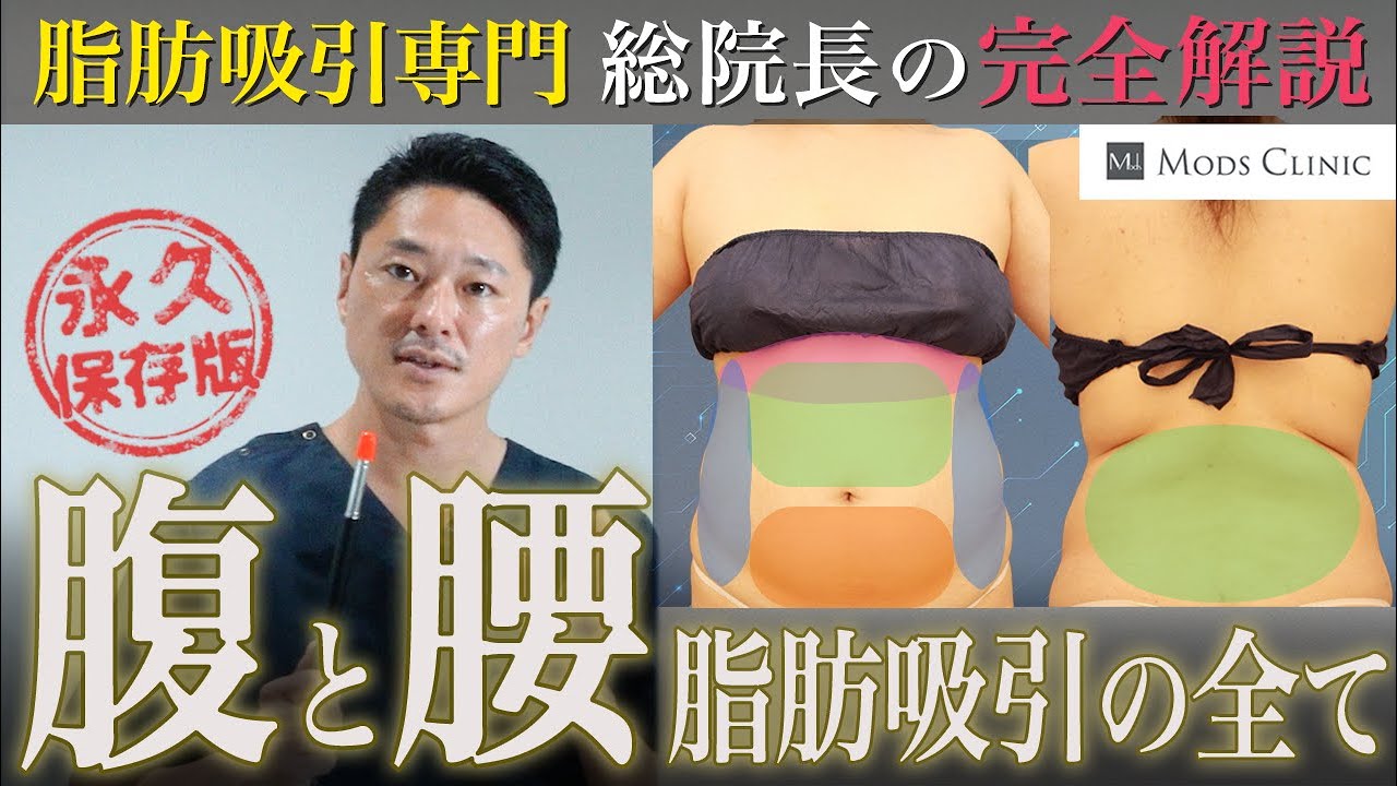 お腹と腰の脂肪吸引を失敗しないために絶対覚えておくべき4つのこと【永久保存版】モッズクリニック総院長 長野寛史