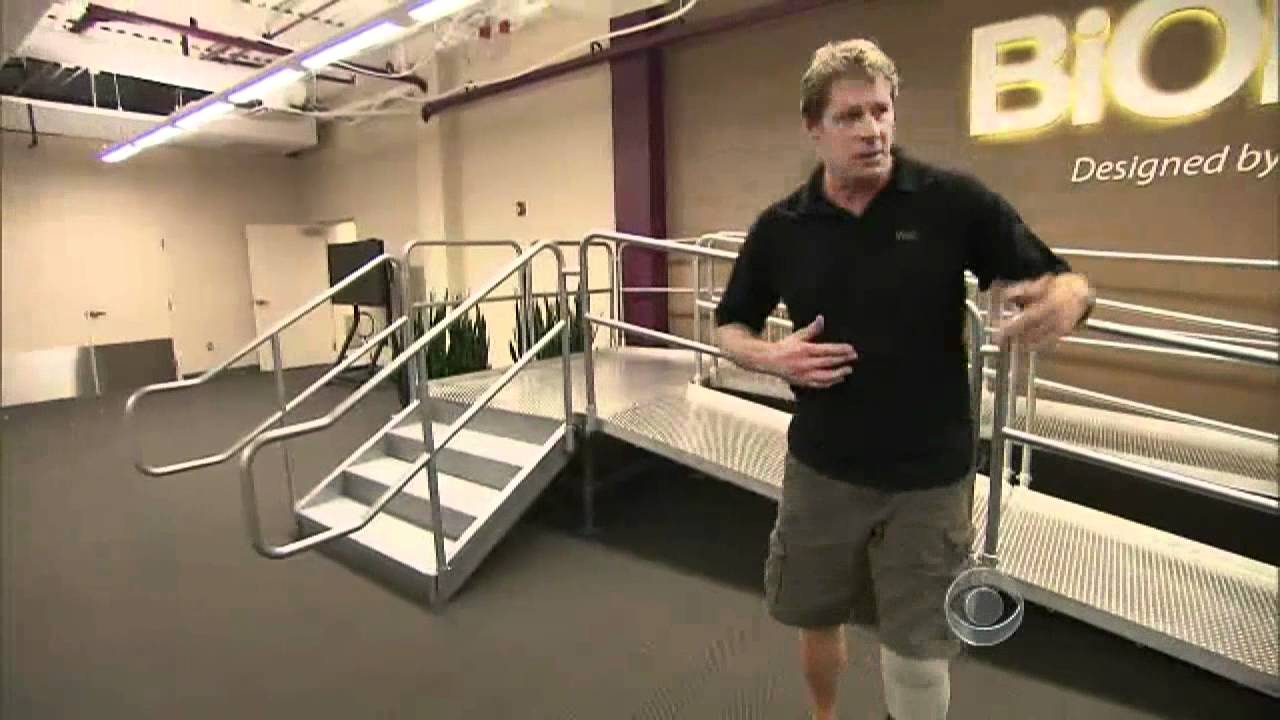 Bionic limbs giving new life to amputees