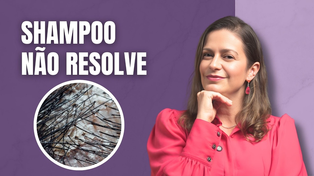 Por que sua dermatite seborreica sempre volta?