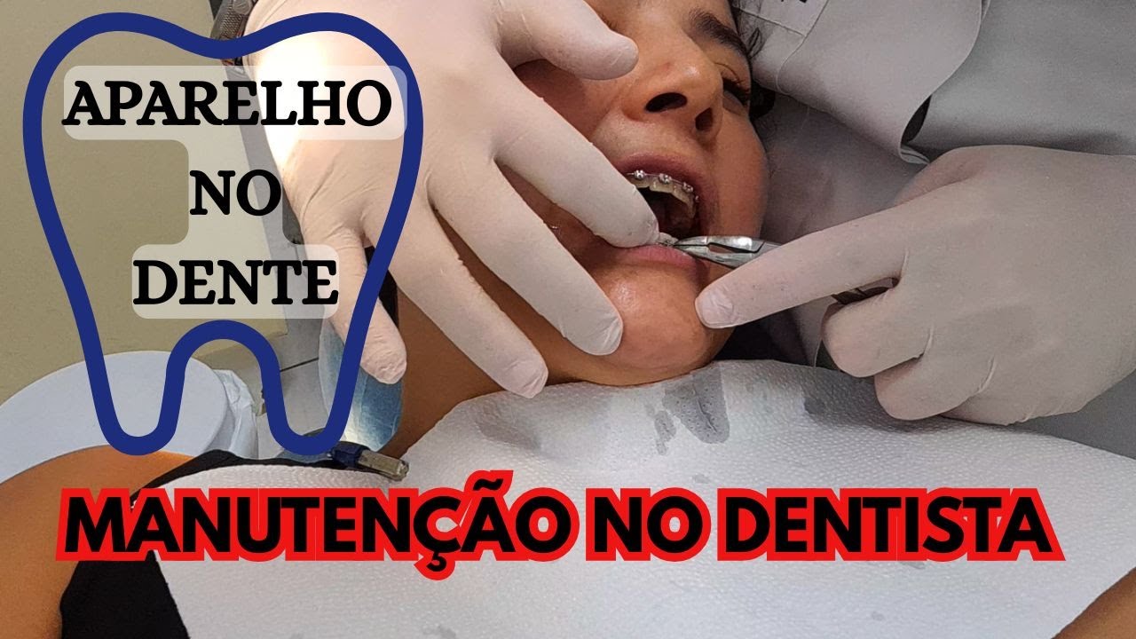 MANUTENÇÃO NO DENTISTA - Cada dia mais elásticos #dentes #aparelhoortodontico