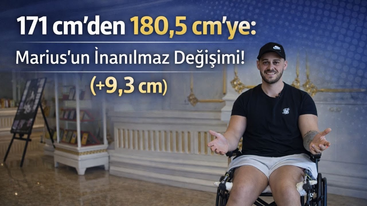 171 cm’den 180,5 cm’ye: Marius’un İnanılmaz Değişimi! (+9,3 cm)