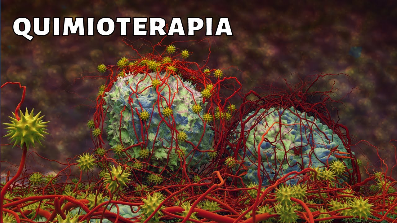 La QUIMIOTERAPIA explicada: cómo funciona, tipos, efectos secundarios