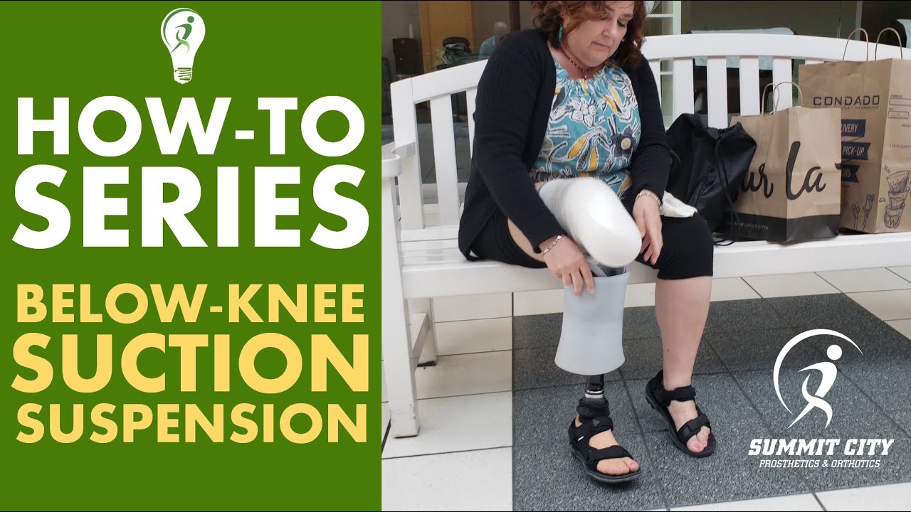 Below-Knee Suction Suspension: How-To Series