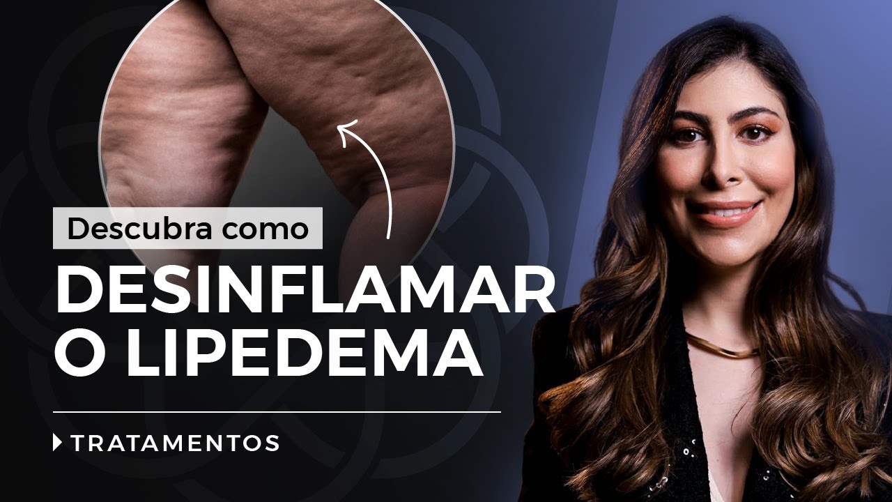 Como desinflamar o lipedema? Melhores tratamentos, por Dra. Dani Aidar Dermatologista