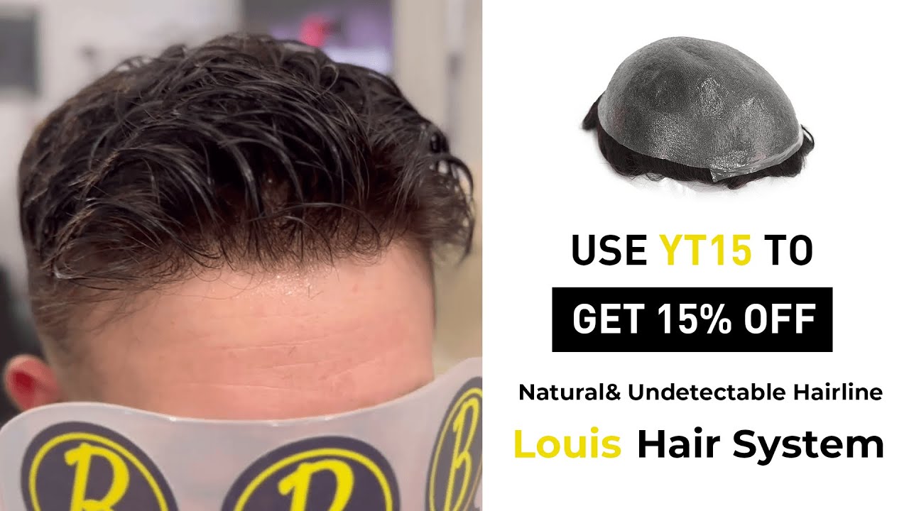 Natural& Undetectable Hairline | 15% OFF | Lavivid Louis Hair System
