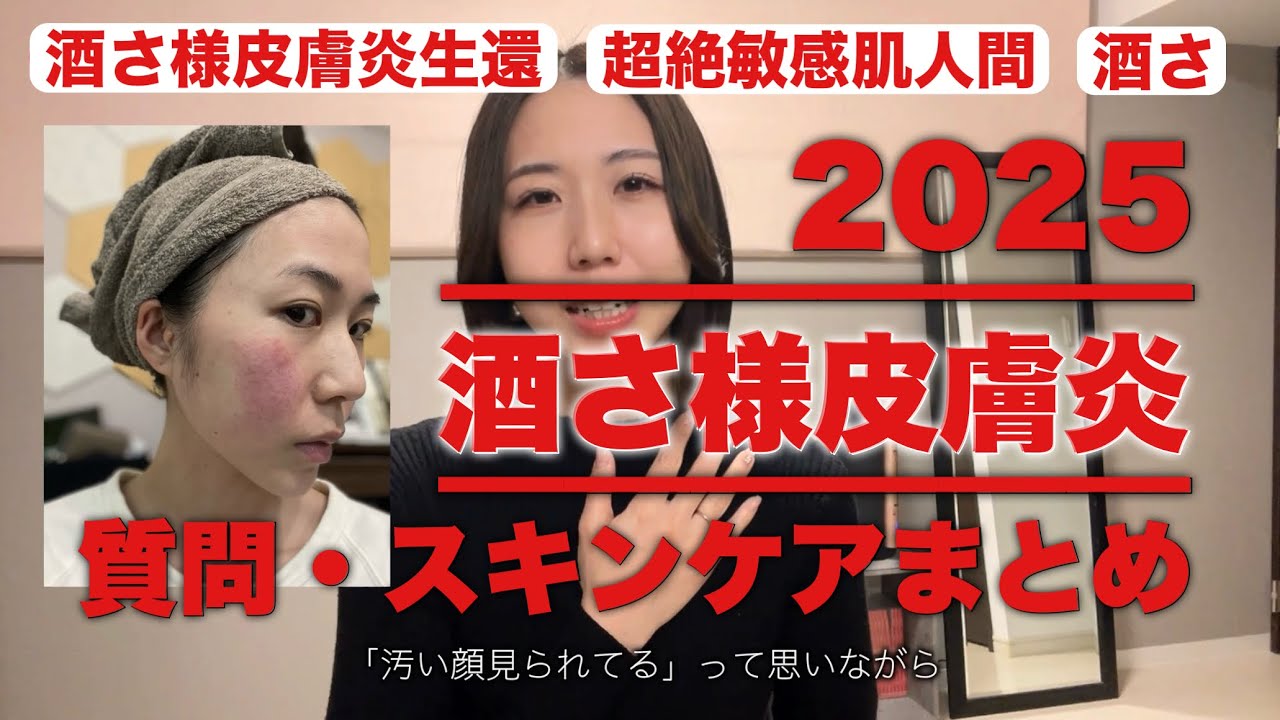 【酒さ様皮膚炎】ロゼックスゲル｜スキンケア｜脱保湿その後｜洗顔｜概要欄にURLあります