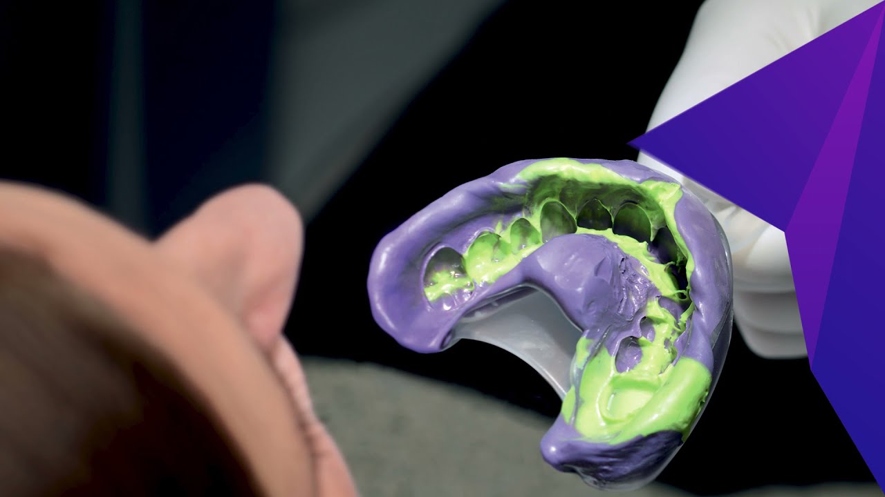 3M&trade; Impregum&trade; Super Quick Polyether Impression Material