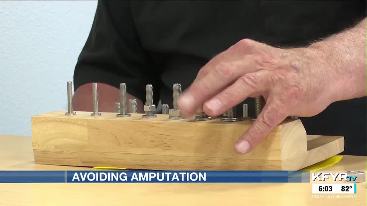 Occupational therapy helps man avoid hand amputation
