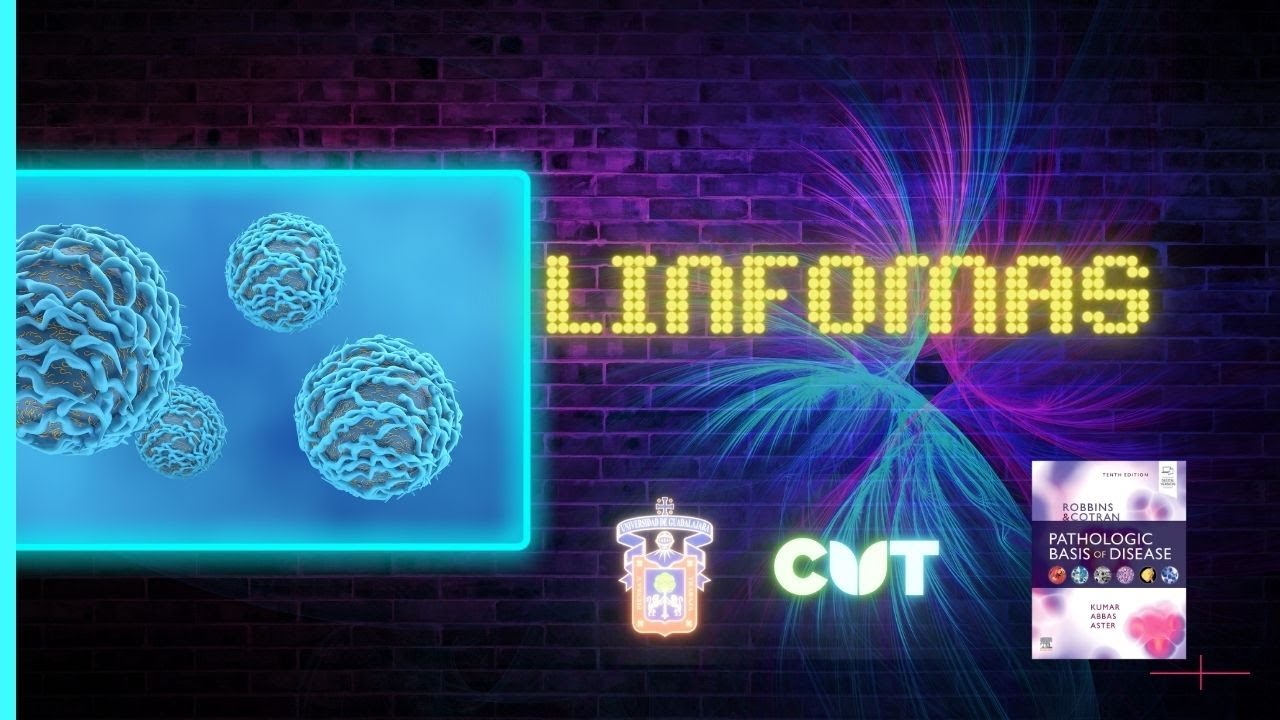 Emisión en directo -  Linfomas -  Curso 2022B