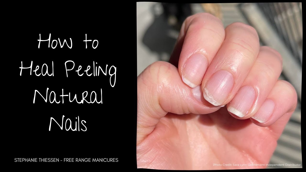 How to Heal Peeling Natural Nails