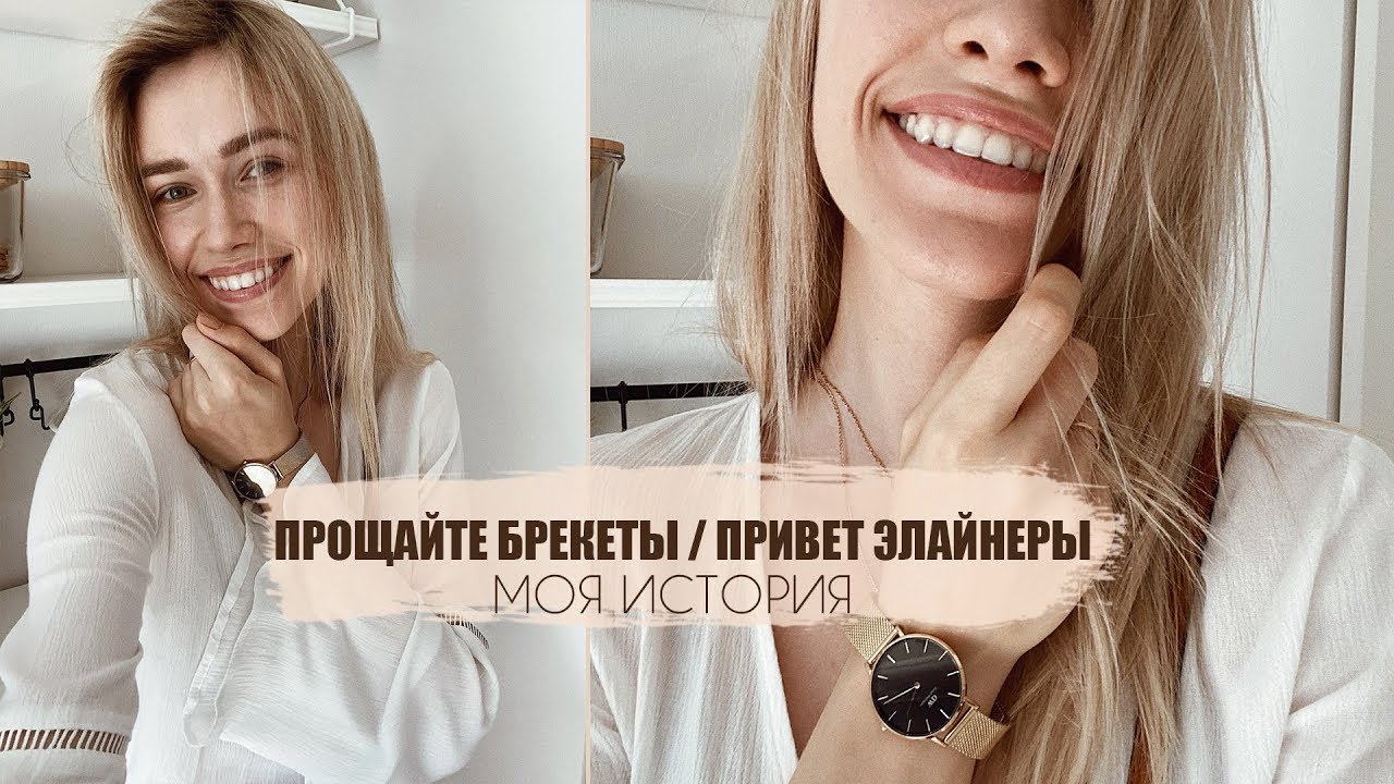 СНЯЛИ БРЕКЕТЫ | ВЫРАВНИВАНИЕ ЗУБОВ ЭЛАЙНЕРАМИ