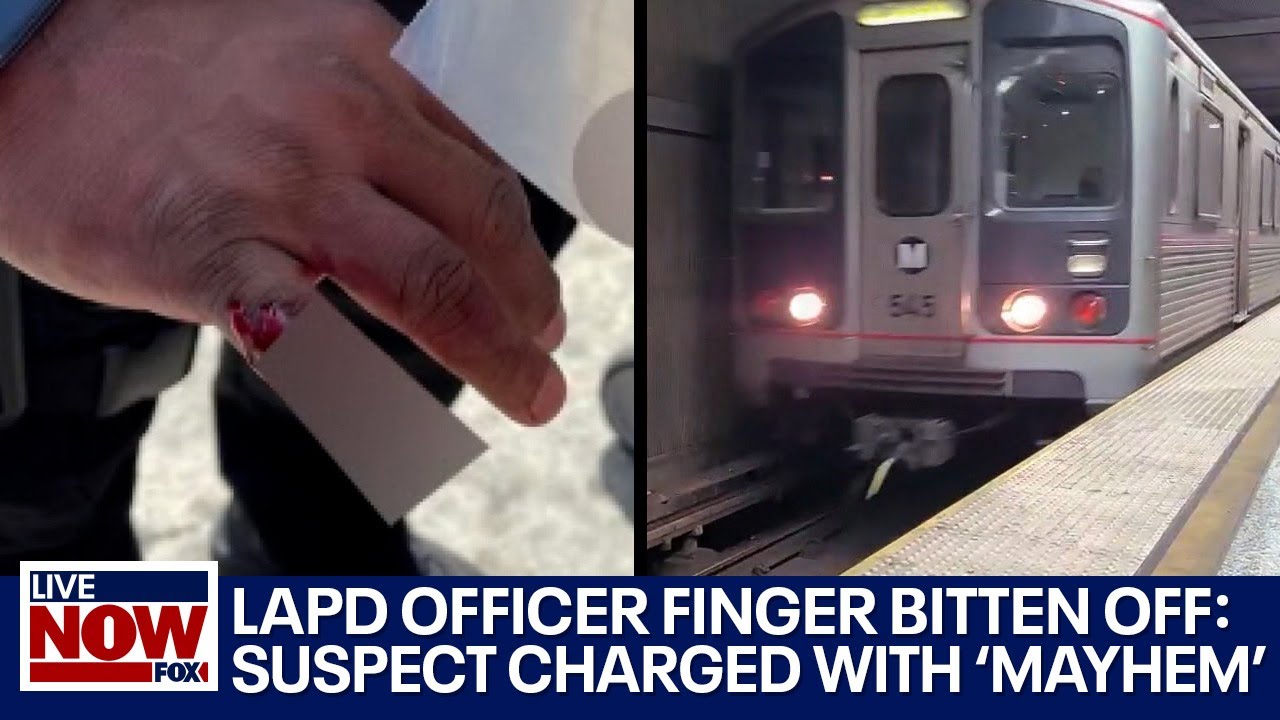 LA officer finger bitten off: Suspect charged with 'mayhem,' held on $100k bail | LiveNOW from FOX