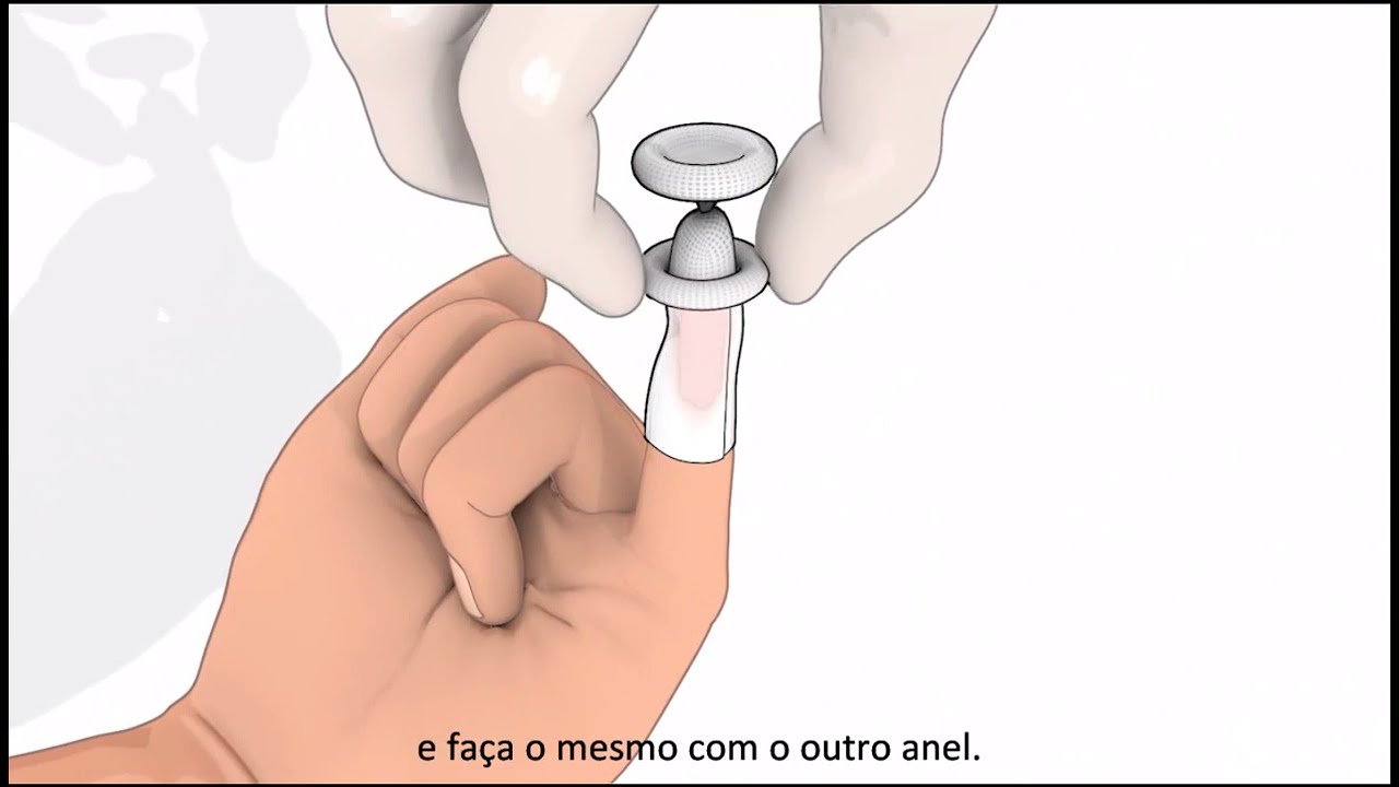 Curativo Systagenix Adaptic Digit Malha n&atilde;o Aderente - Compre na Vitae Sa&uacute;de!