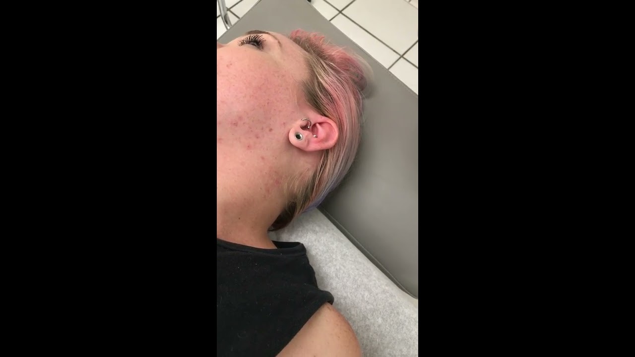 Double Conch Piercing on Brandi