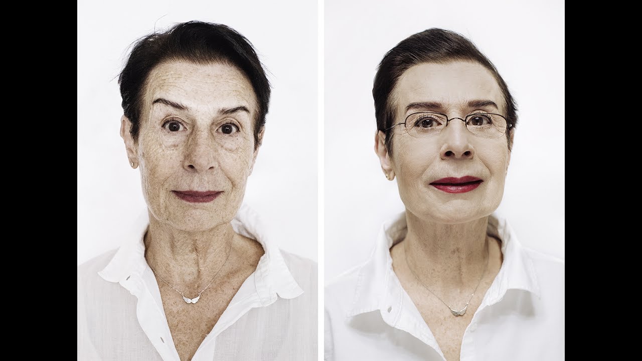 MASI Medycyna Estetyczna Szczecin - Metamorfoza kobiety dojrzałej