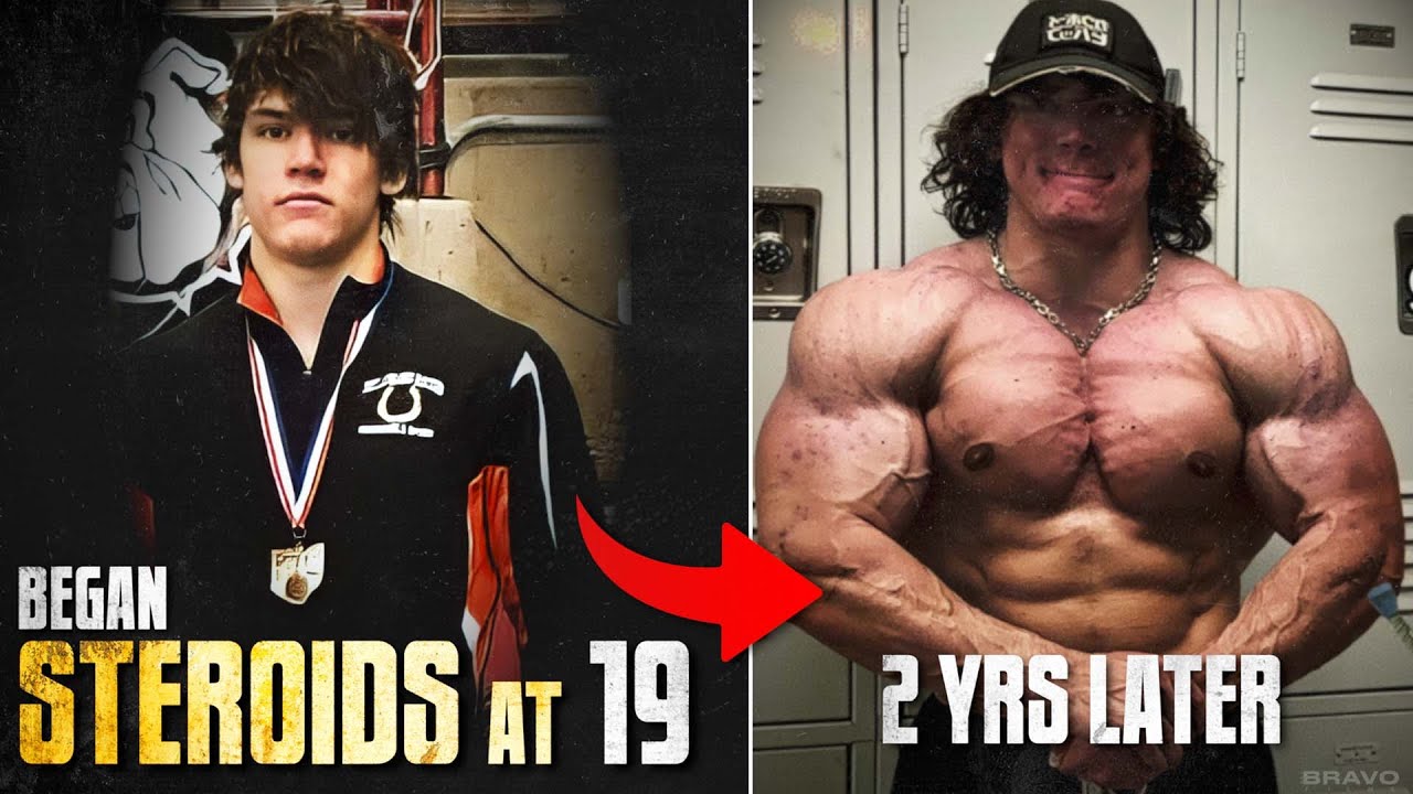 Sam Sulek DANGEROUS Dive Into STEROID Abuse
