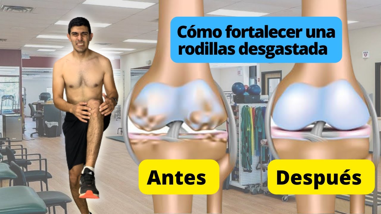Cómo fortalecer las rodillas cuando tenemos desgaste de rodillas