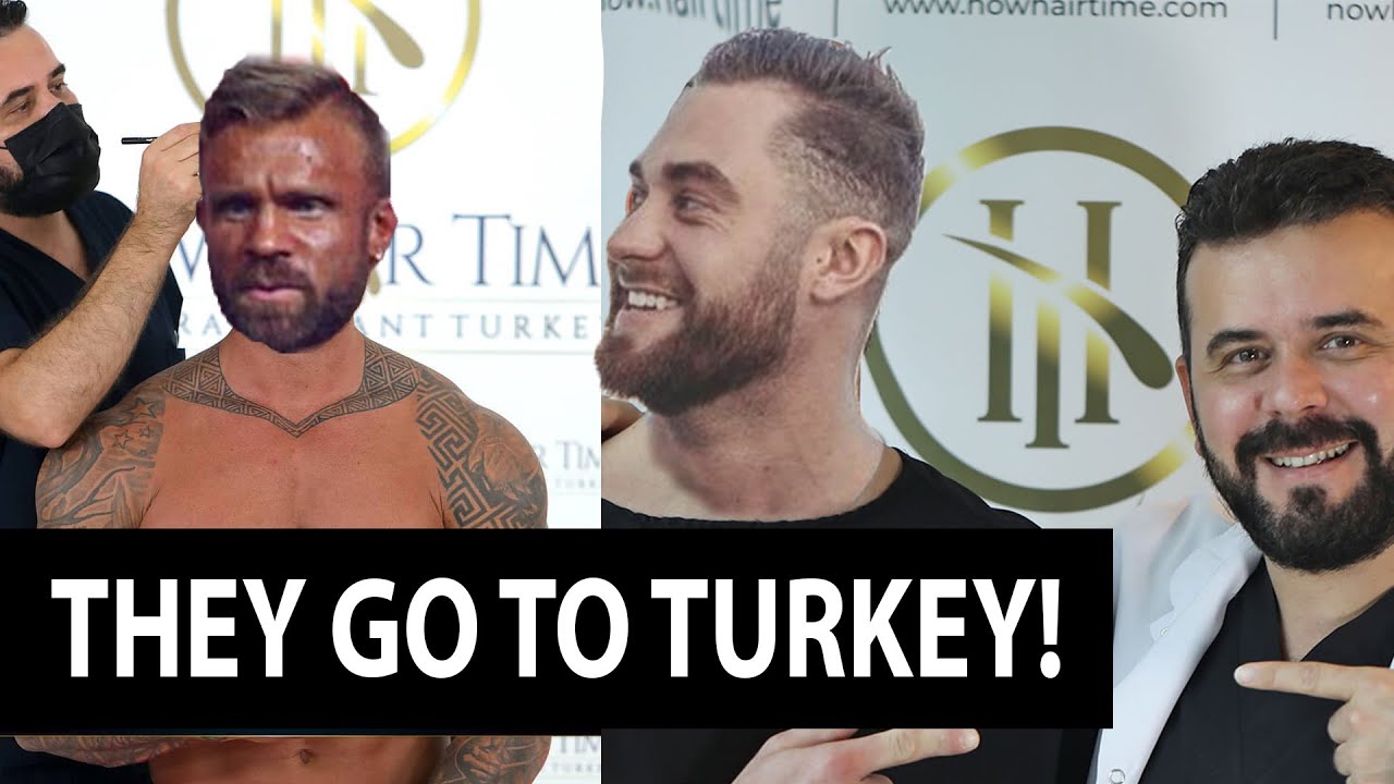 Chris Bumstead and Iain Valliere Go To Turkey for Hair Transplant!