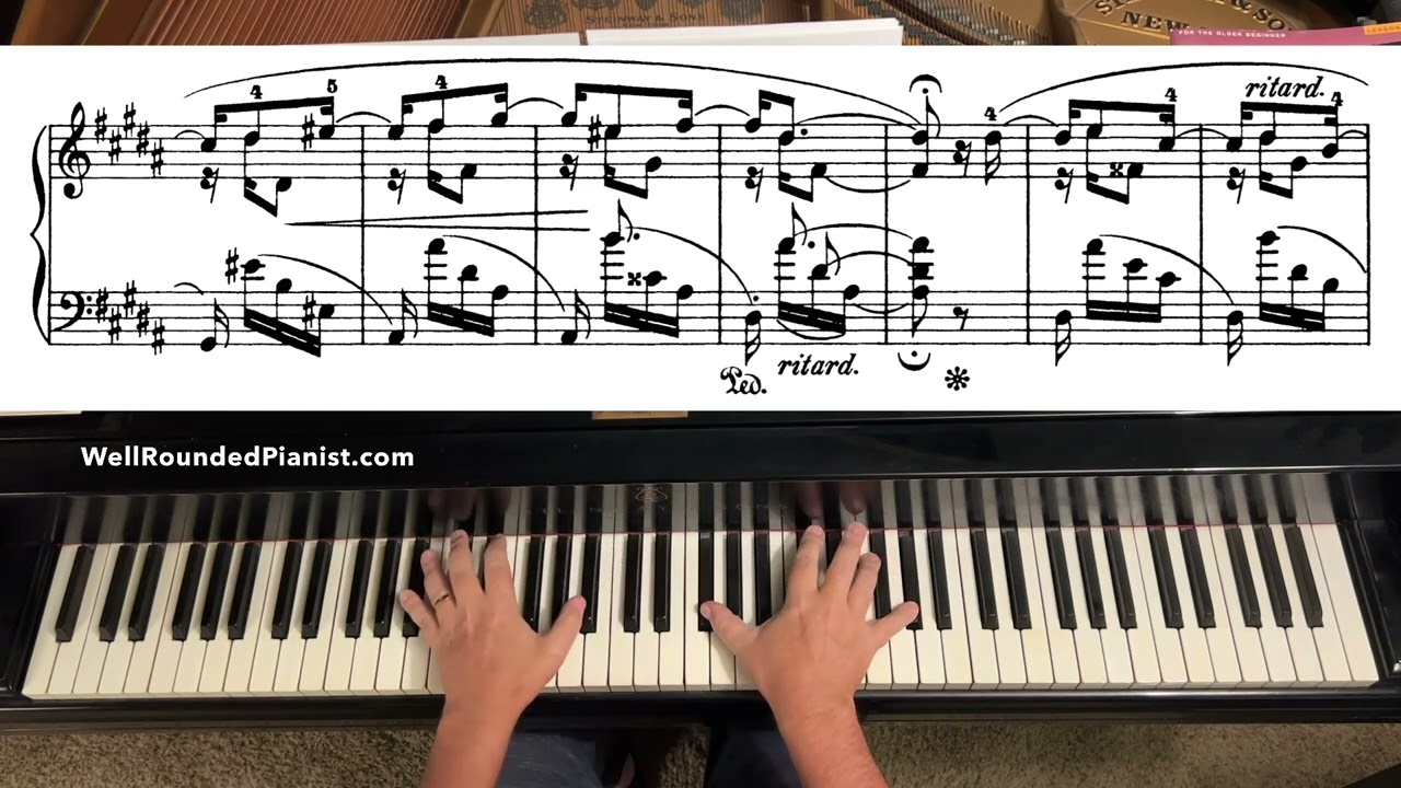 SCHUMANN: Almost Too Serious | Kinderszenen (Op. 15, No. 10) | with FREE Sheet Music
