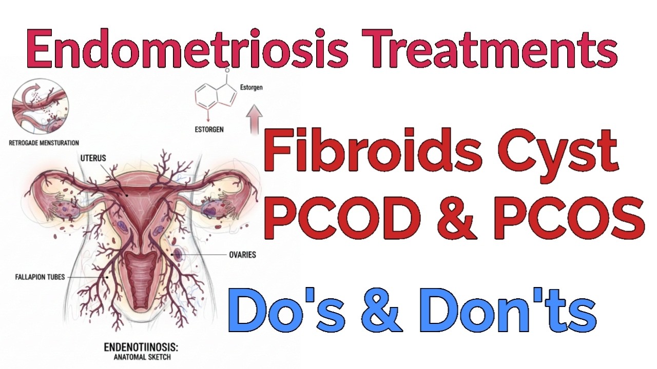 Endometriosis Treatments, Fibroids cyst, PCOD& PCOS , Dr Shalini
