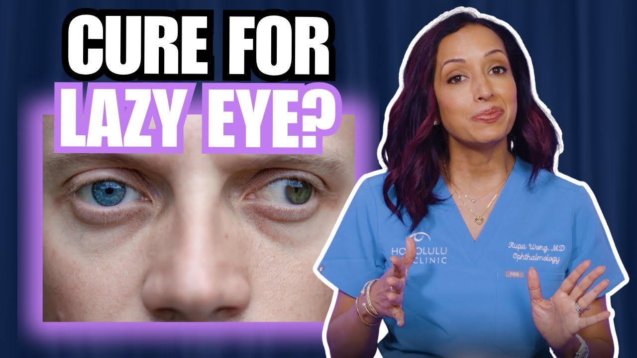 Best Amblyopia Treatments Explained: What Really Works for Lazy Eye