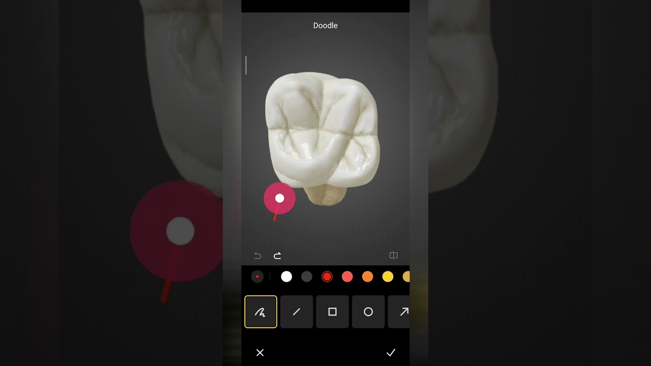تشريح ونحت الأسنان-المعالم التشريحية للأسنان
