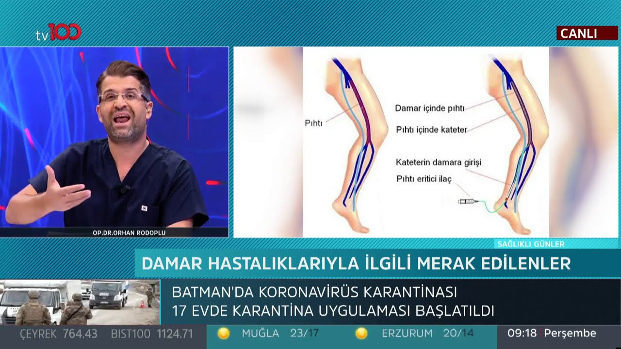 Kalp damar hastalıklarıyla ilgili merak edilen sorular - Sağlıklı Günler - 20 Ağustos 2020