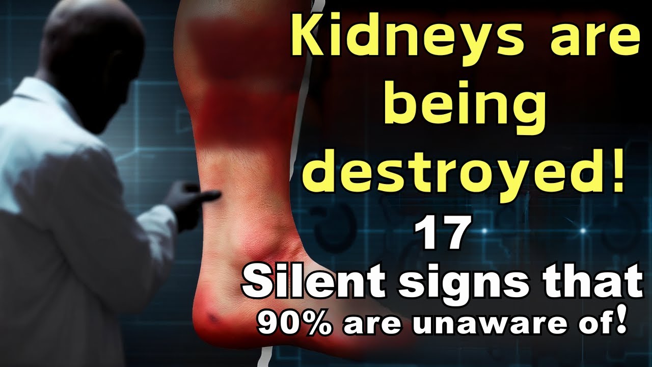 Kidney Specialist If You Have These 17 Symptoms, Your Kidneys Are in Serious Danger! Immediate Home