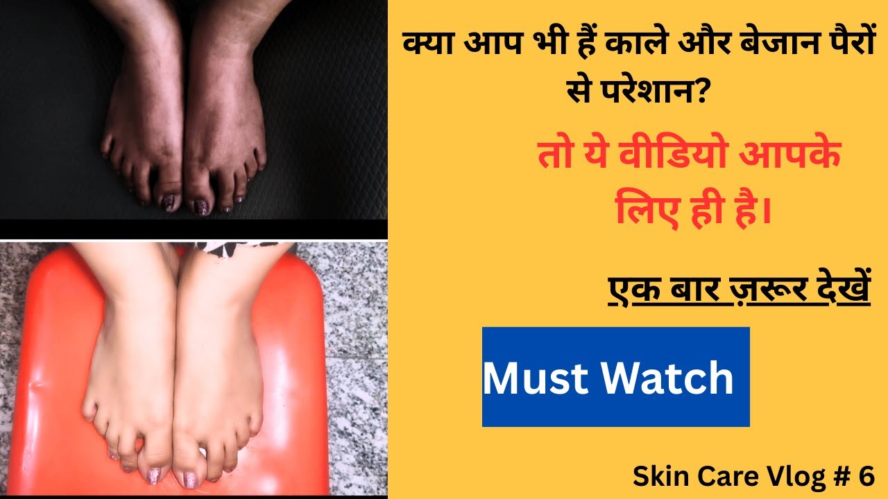 बिना पैसा खर्च किए काले पैरों को गोरा कैसे करें? (100% काम करेगा)| Kale pairo ko gora kaise kare?