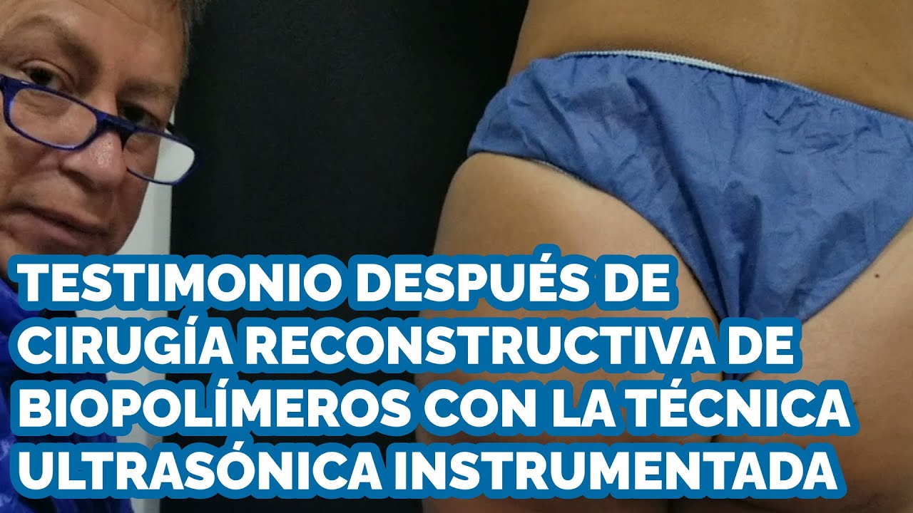 Testimonio después de cirugía reconstructiva de biopolímeros con la técnica ultraónica instrumentada