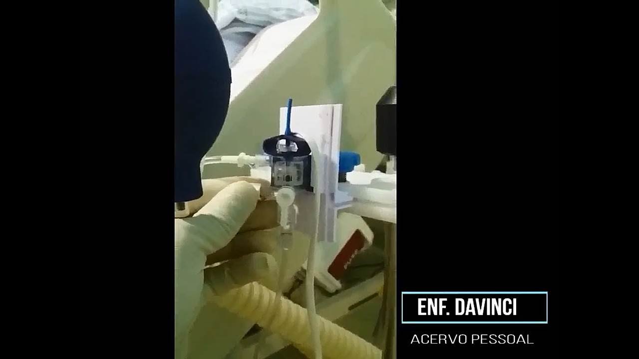 P.A.I. (Press&atilde;o Arterial Invasiva)  parte 2