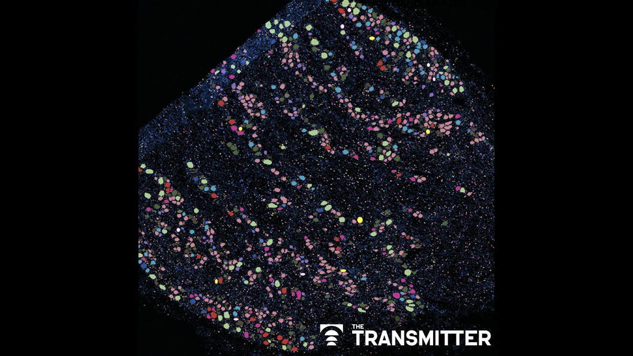 'Unprecedented' dorsal root ganglion atlas captures 22 types of human sensory neurons