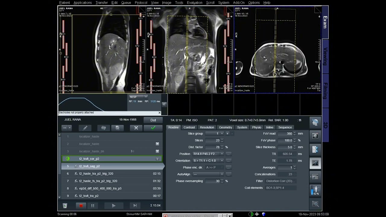How to MRI of  MRCP Planning