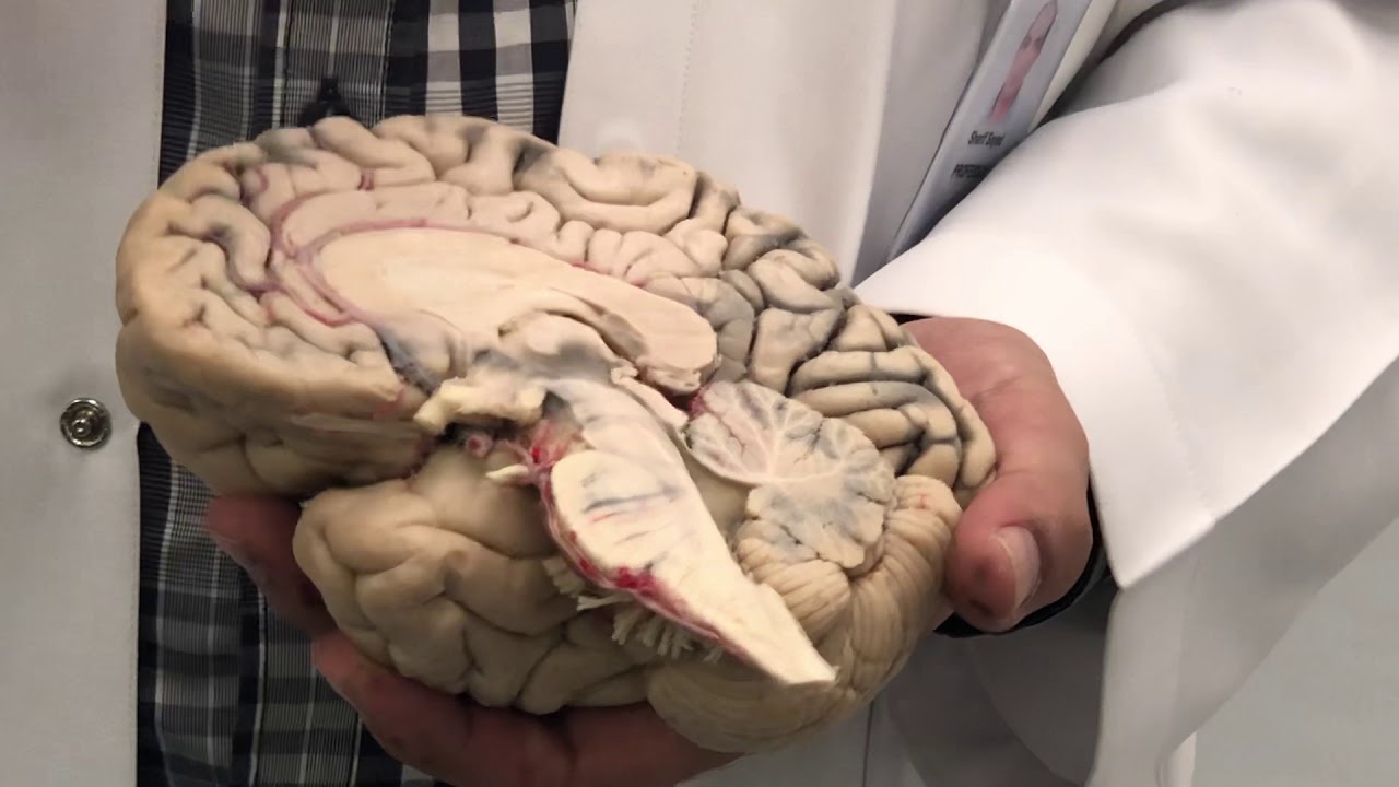 Sagittal brain section (Neuroanatomy 5)