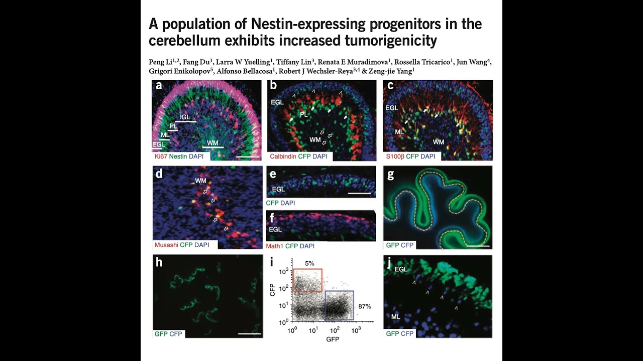 617-The Origins of Medulloblastoma