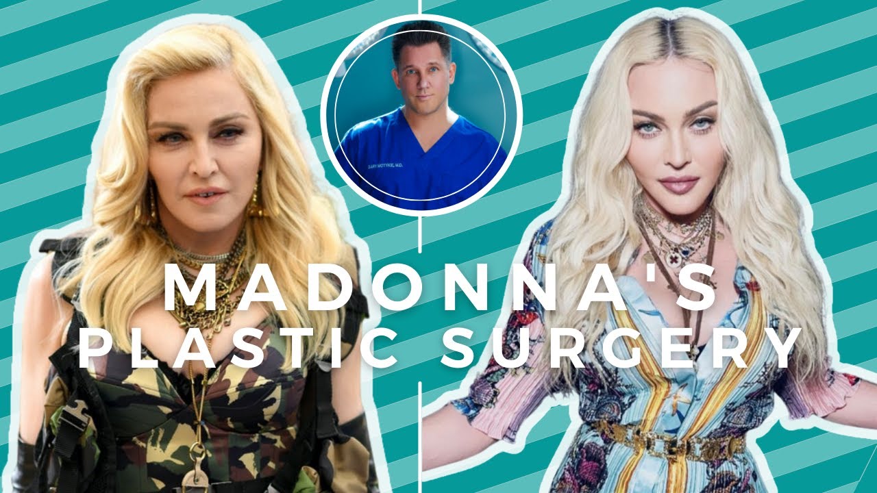 Madonna's Recent Plastic Surgery + Why Cher Looks Good