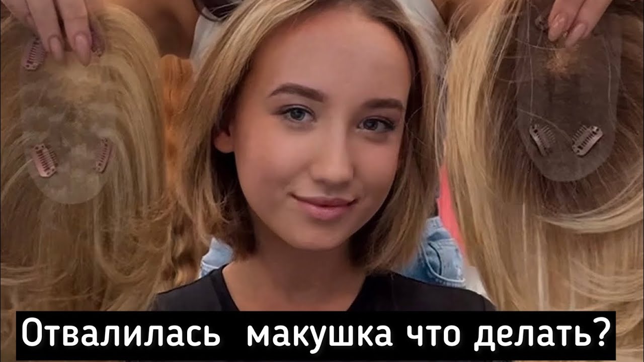 Накладка на макушку