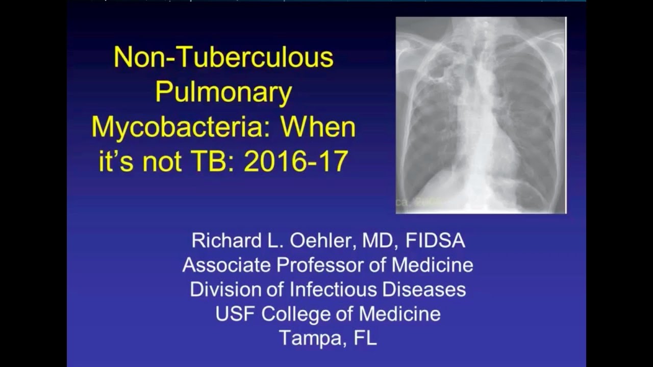 NonTuberculous Mycobacteria Update -- Richard L Oehler, MD