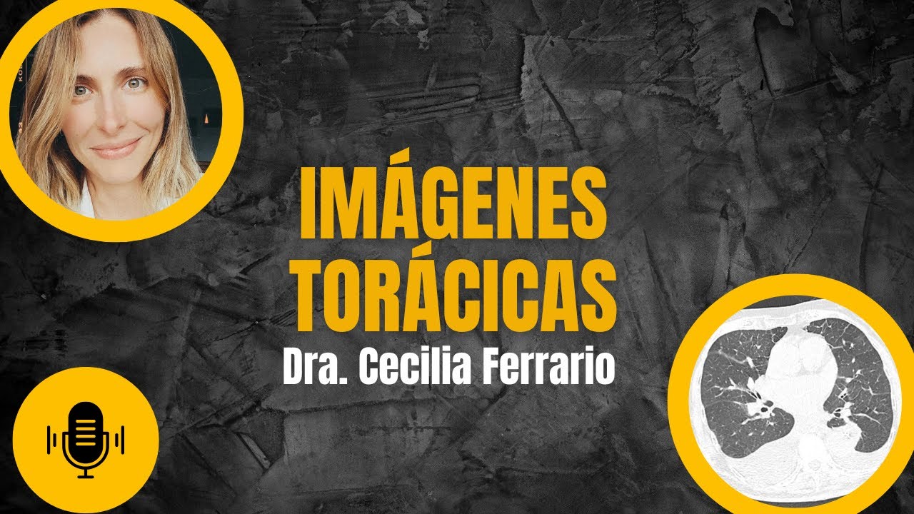 Imágenes Torácicas Podcast: Aprendé Radiología en Equipo, Fácil y Aplicado