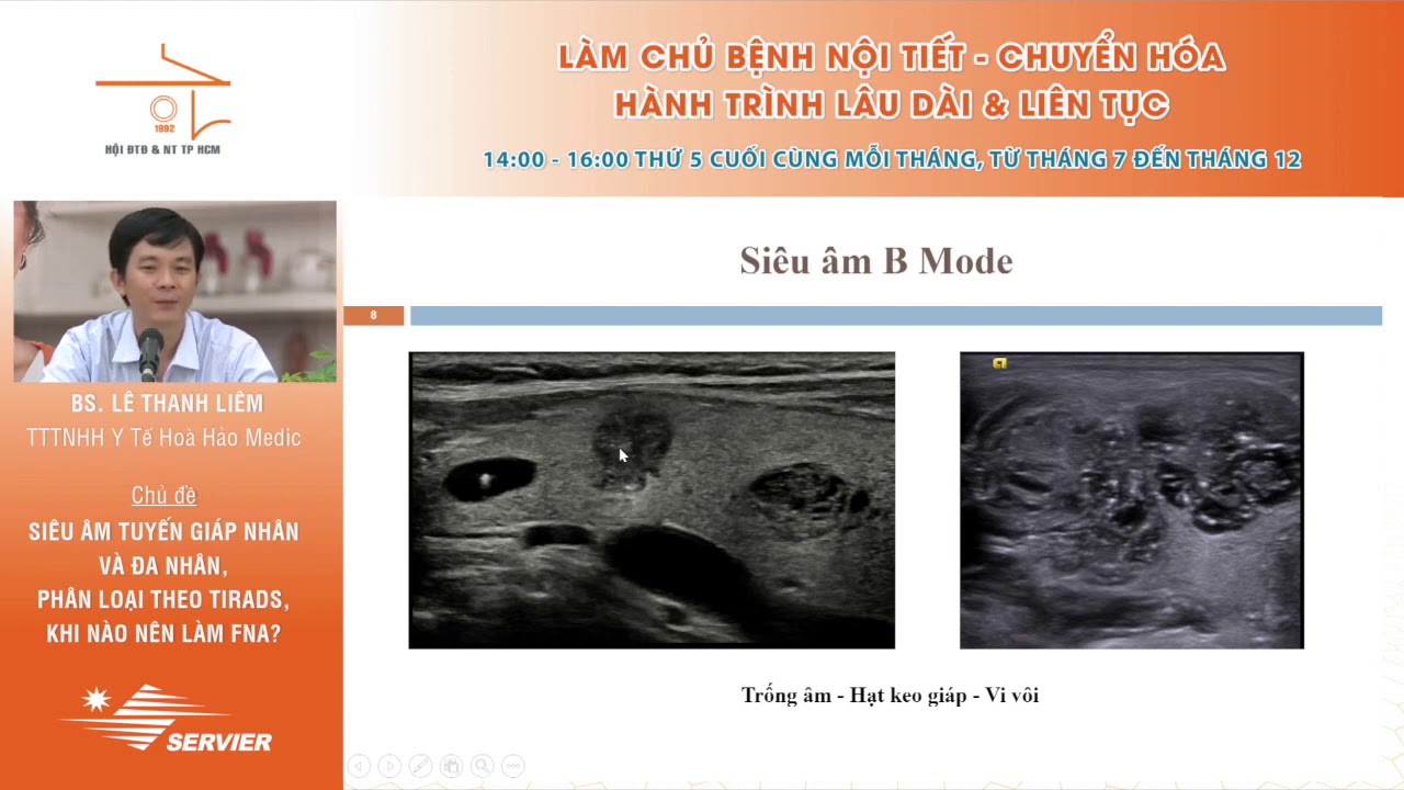 SIÊU ÂM CHẨN ĐOÁN BƯỚU GIÁP NHÂN | PHÂN LOẠI THEO TIRADS | CHỈ ĐỊNH FNAC | BS. LÊ THANH LIÊM