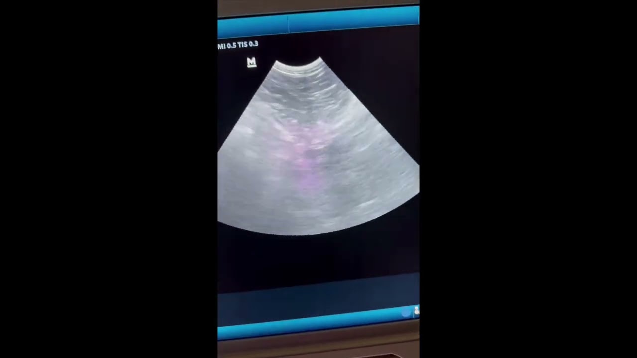 2020 Mindray V5 Vet Ultrasound with Cart & Probe - LOCAL PICK UP ONLY in SF Bay area, CA