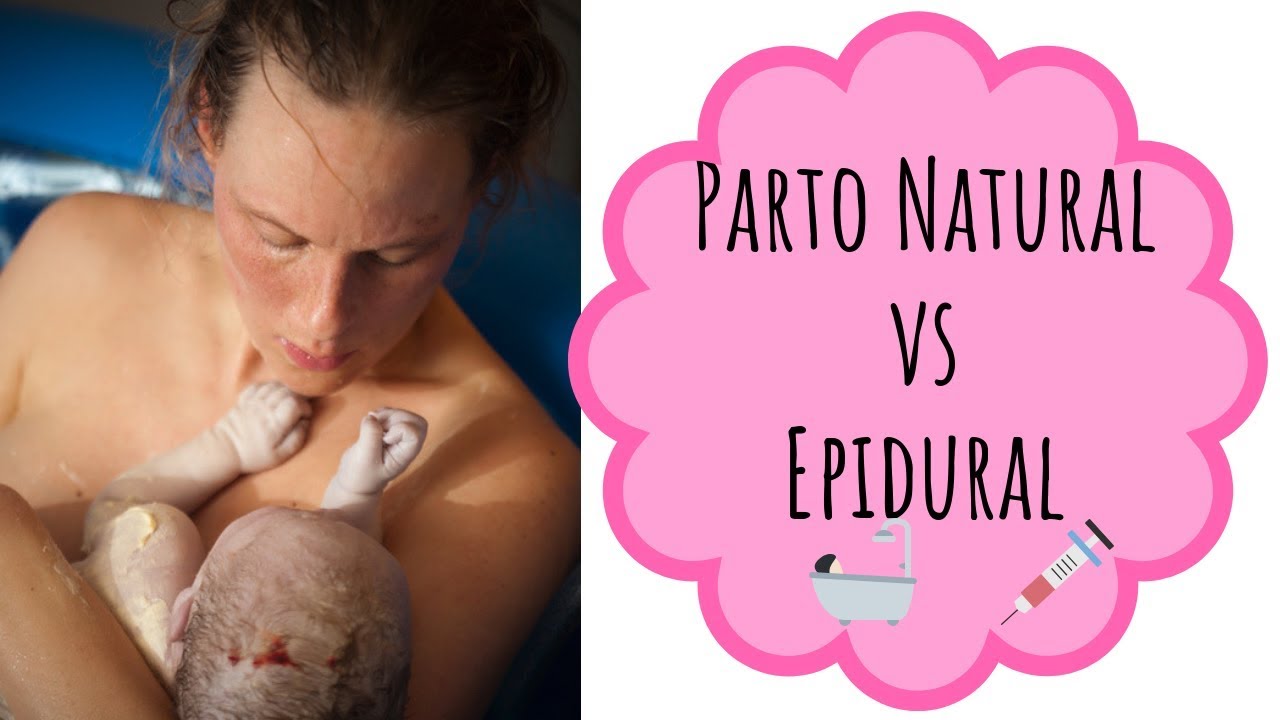 PARTO NATURAL  o con EPIDURAL 💉. Pros y contras.