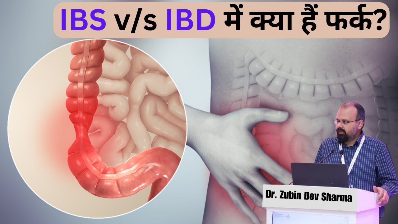 IBS v/s IBD में क्या हैं फर्क? || Difference between IBS vs IBD? #ibd #ibs #drzubindevshrma