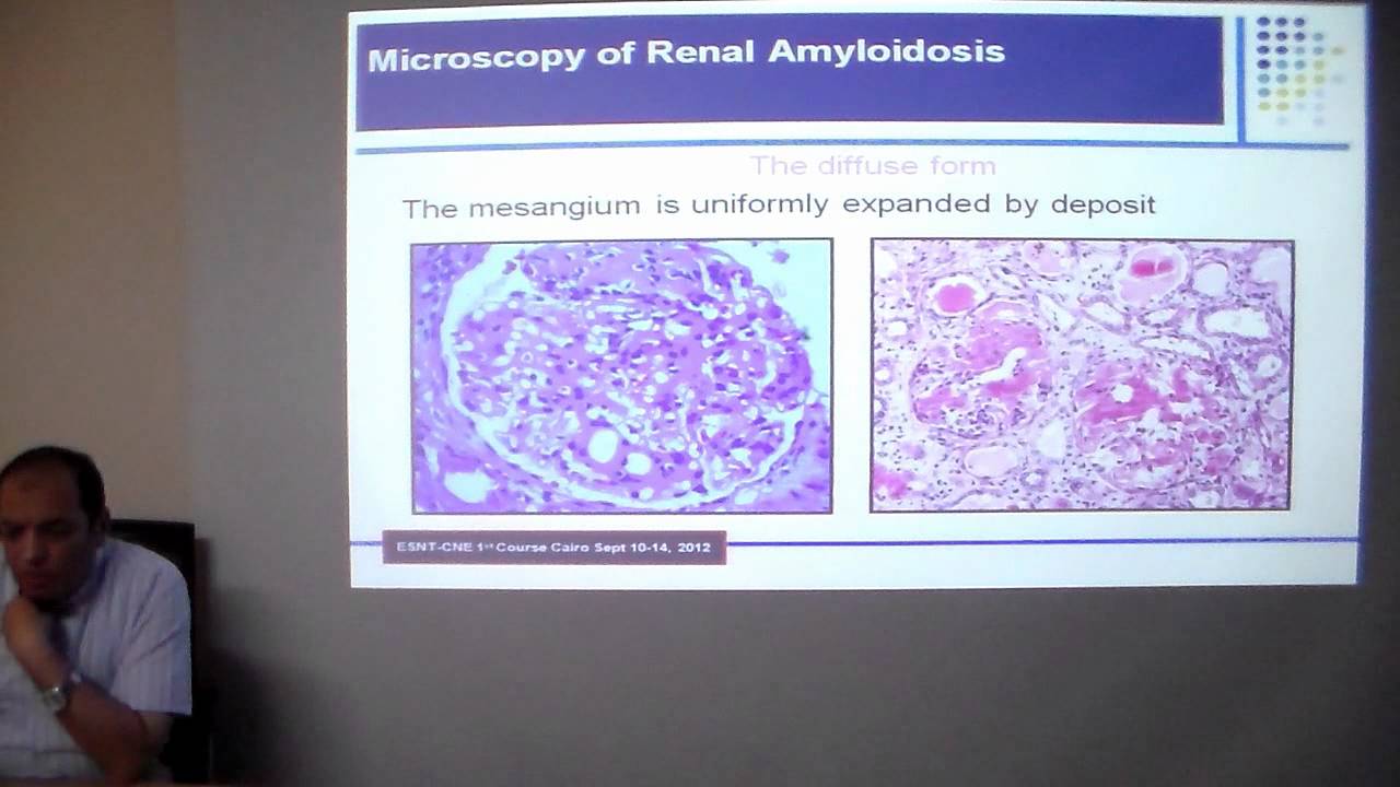 FMF and renal amyloidosis  prof  Ayman Refaie, Mansoura UNC