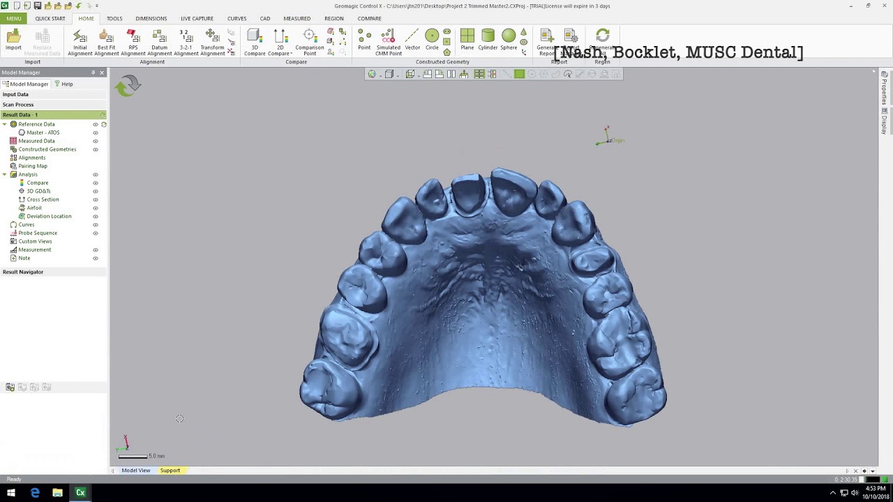 Dental Application of Geomagic Control X