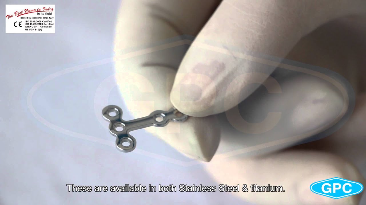 Mini T Plate | Maxillofacial Plates Manufacturer | 1.5mm Mini T Plates