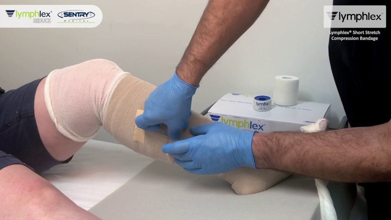 Lymphlex® REDUCE Application | Sentry Medical