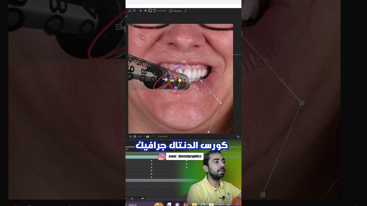 Glimpses of the Dental motion graphics Course
